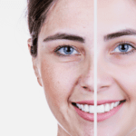 Benefits of Agebiotics